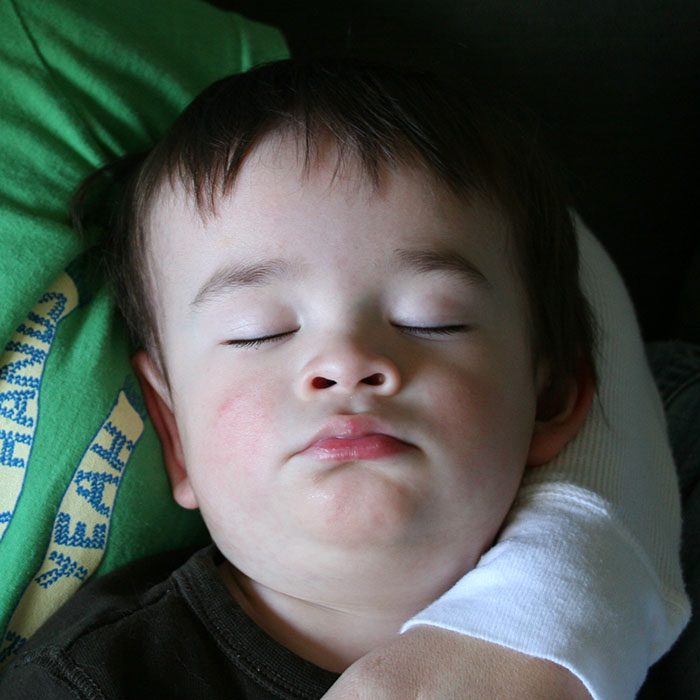 sleep-apnea-2022_700.jpg